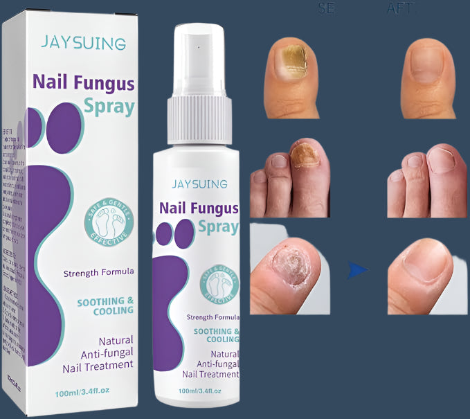 Gentle Nail Fungus Remover Maxum